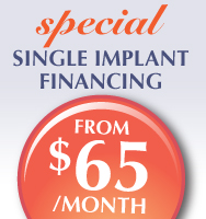 Financing for Dental Implants - from a dentist in Mississauga